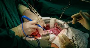 transplantacija organa